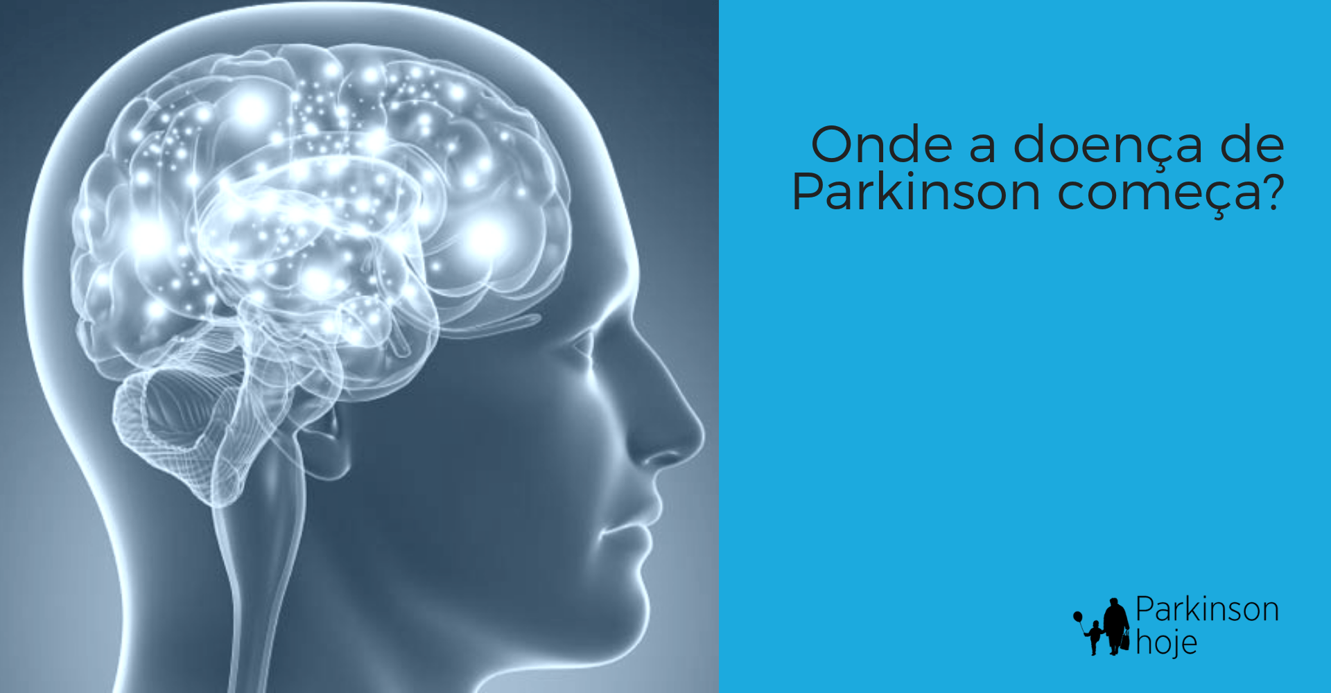 parkinson pode ter origem no apêndice