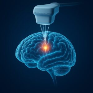 Leia mais sobre o artigo HIFU – (Ultrassom Focalizado de Alta Intensidade) no Tratamento de Tremores: Mitos e Verdades